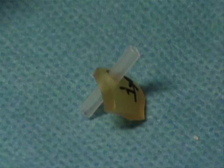 Optimized System for Cerebral Perfusion Monitoring in the Rat Stroke Model of Intraluminal Middle Cerebral Artery Occlusion