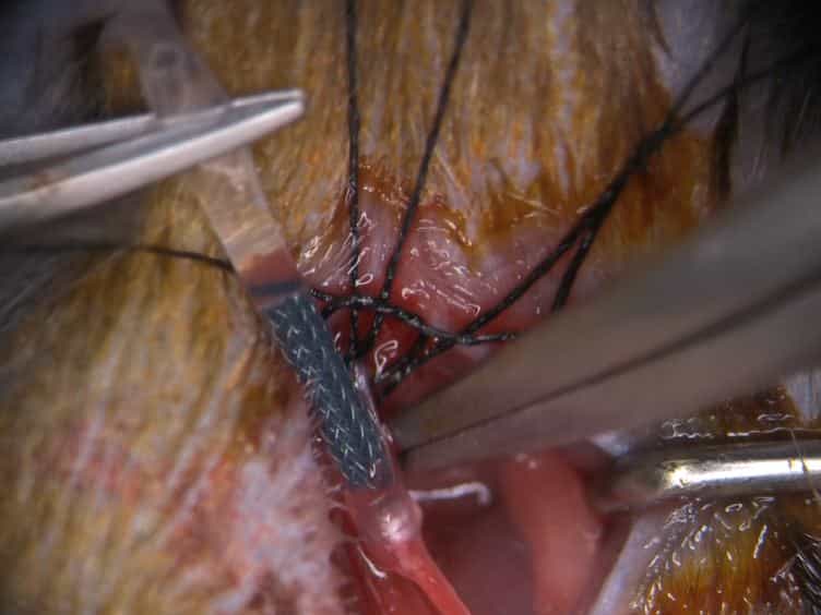 A Murine Model of Stent Implantation in the Carotid Artery for the Study of Restenosis