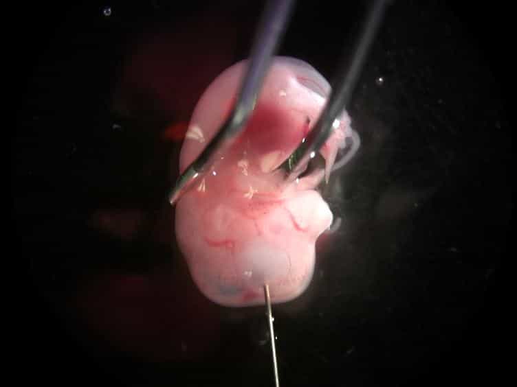Ex utero Electroporation and Whole Hemisphere Explants: A Simple Experimental Method for Studies of Early Cortical Development