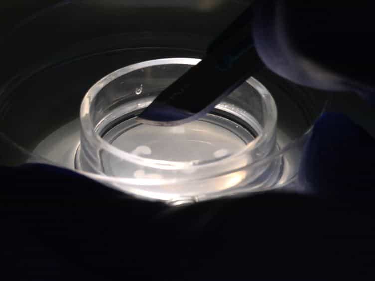 Post-embedding Immunogold Labeling of Synaptic Proteins in Hippocampal Slice Cultures