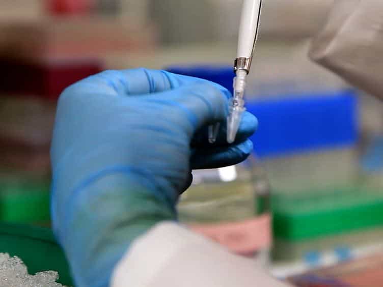 Purification and microRNA Profiling of Exosomes Derived from Blood and Culture Media