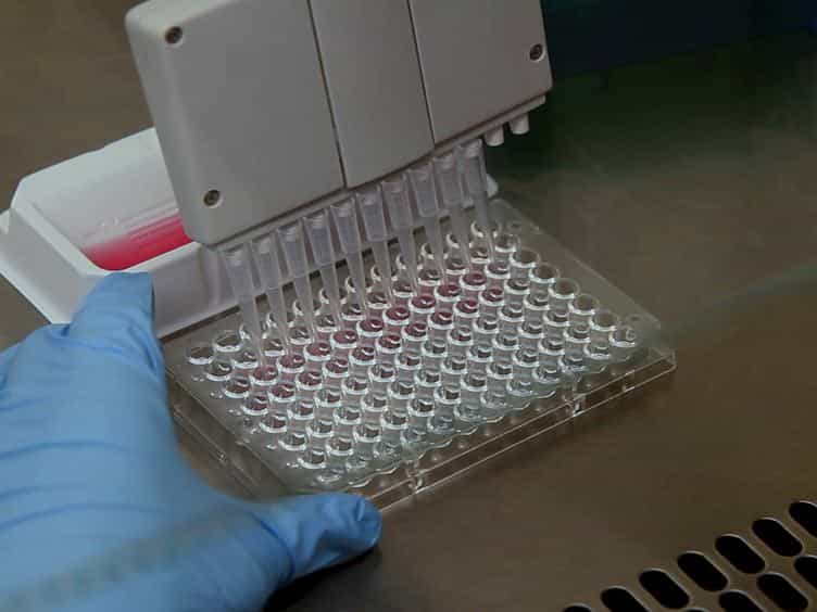 Development, Expansion, and In vivo Monitoring of Human NK Cells from Human Embryonic Stem Cells (hESCs) and Induced Pluripotent Stem Cells (iPSCs)
