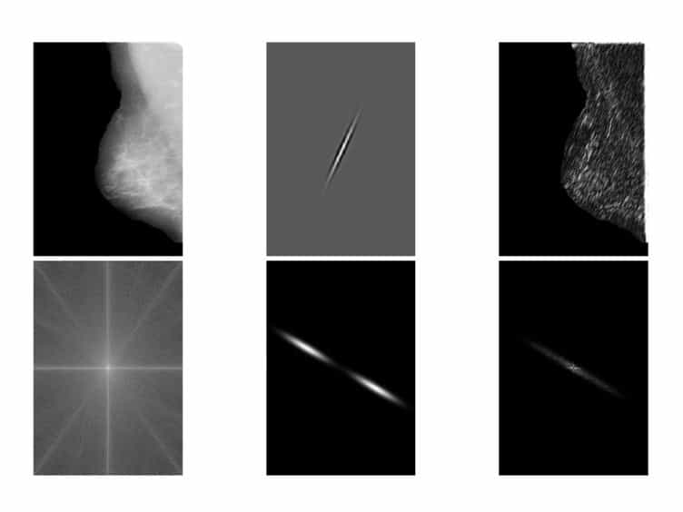 Detection of Architectural Distortion in Prior Mammograms via Analysis of Oriented Patterns