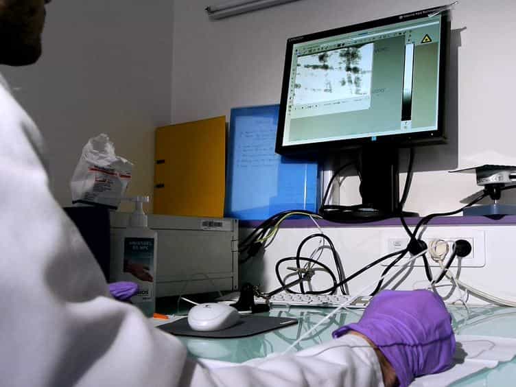 In vivo Imaging of Tumor Angiogenesis using Fluorescence Confocal Videomicroscopy