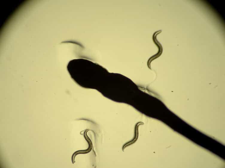 In vivo Neuronal Calcium Imaging in C. elegans