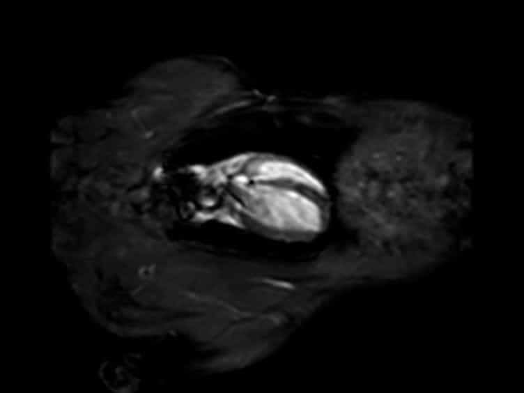 Assessment of Cardiac Function and Myocardial Morphology Using Small Animal Look-locker Inversion Recovery SALLI MRI in Rats