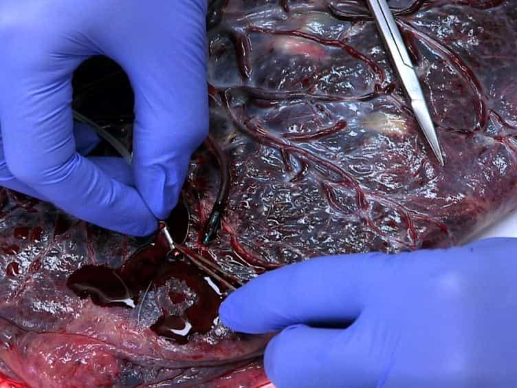 Determination of the Transport Rate of Xenobiotics and Nanomaterials Across the Placenta using the ex vivo Human Placental Perfusion Model