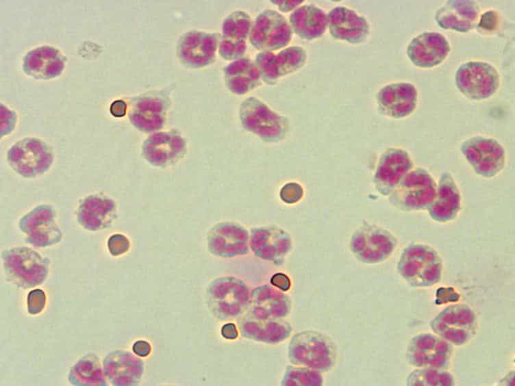 A Simple and Efficient Method to Detect Nuclear Factor Activation in Human Neutrophils by Flow Cytometry
