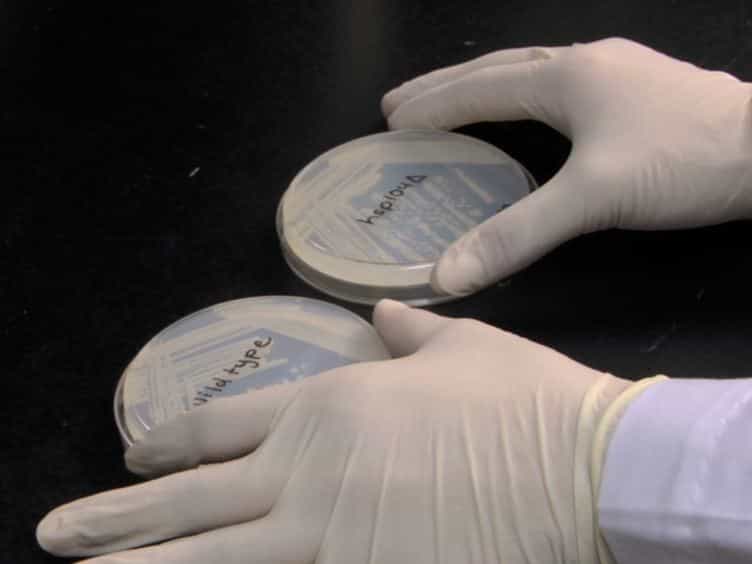 Coupled Assays for Monitoring Protein Refolding in Saccharomyces cerevisiae
