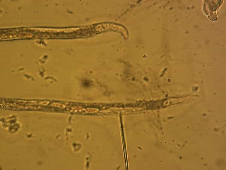 A Caenorhabditis elegans Model System for Amylopathy Study