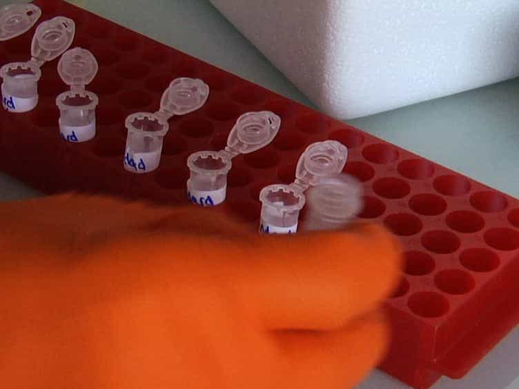 Biochemical Titration of Glycogen In vitro