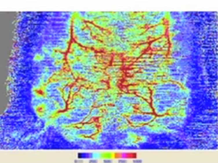 In situ Transverse Rectus Abdominis Myocutaneous Flap: A Rat Model of Myocutaneous Ischemia Reperfusion Injury
