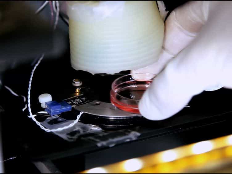 Measurement of Tension Release During Laser Induced Axon Lesion to Evaluate Axonal Adhesion to the Substrate at Piconewton and Millisecond Resolution