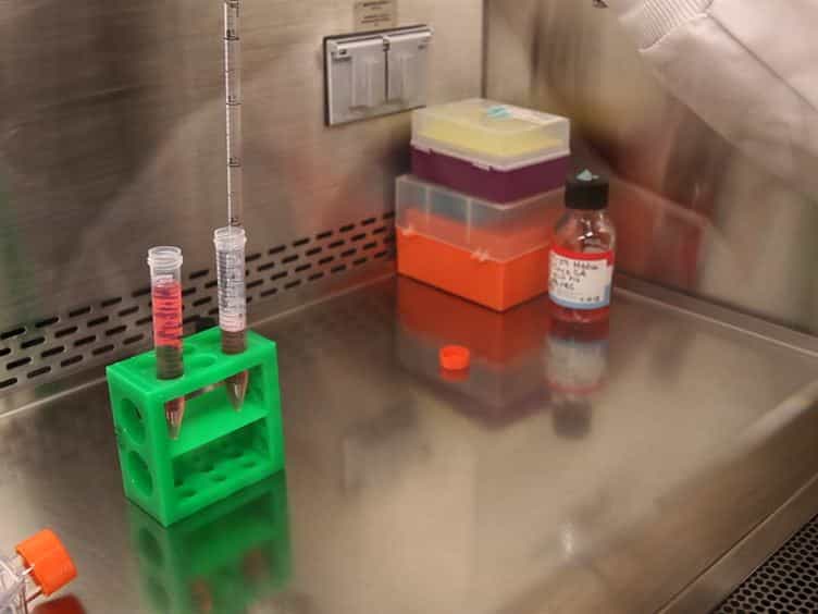 Induction and Analysis of Epithelial to Mesenchymal Transition