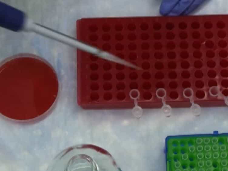Characterization of Inflammatory Responses During Intranasal Colonization with Streptococcus pneumoniae