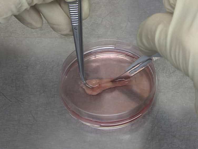 A Human Ex Vivo Atherosclerotic Plaque Model to Study Lesion Biology