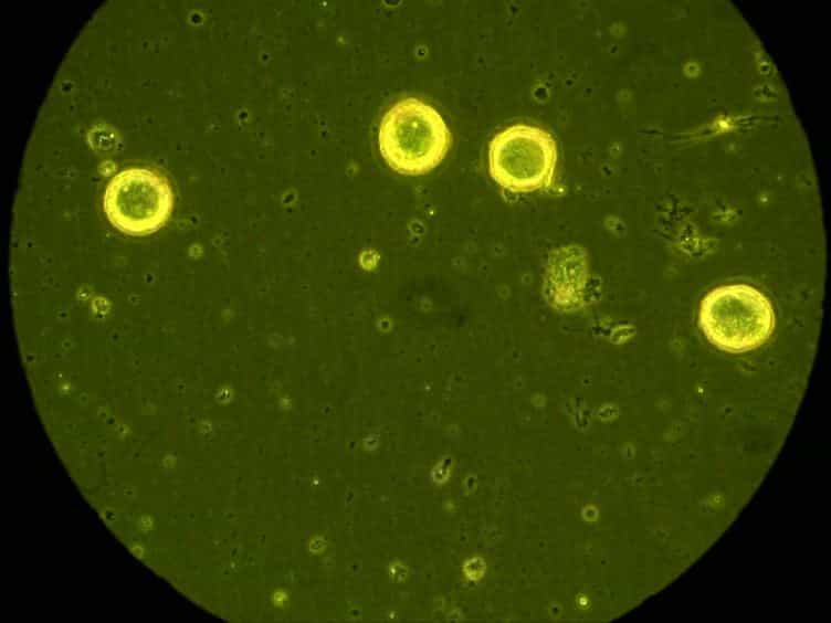 Isolation of Sensory Neurons of Aplysia californica for Patch Clamp Recordings of Glutamatergic Currents