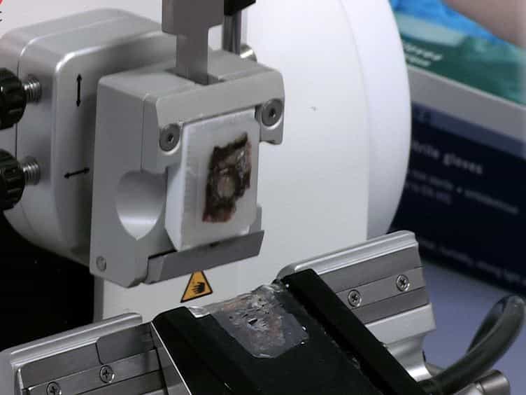Proteomic Sample Preparation from Formalin Fixed and Paraffin Embedded Tissue