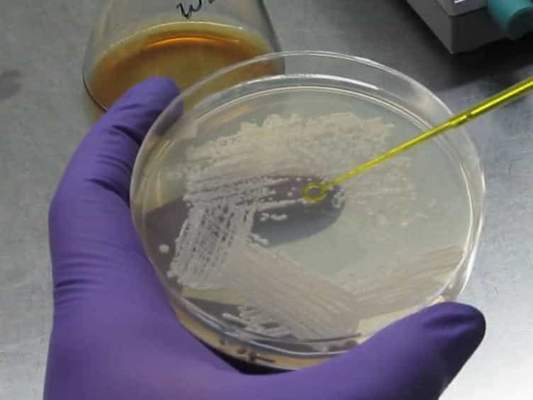 Establishment of an In vitro System to Study Intracellular Behavior of Candida glabrata in Human THP-1 Macrophages