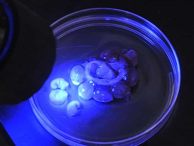 Promotion of Survival and Differentiation of Neural Stem Cells with Fibrin and Growth Factor Cocktails after Severe Spinal Cord Injury