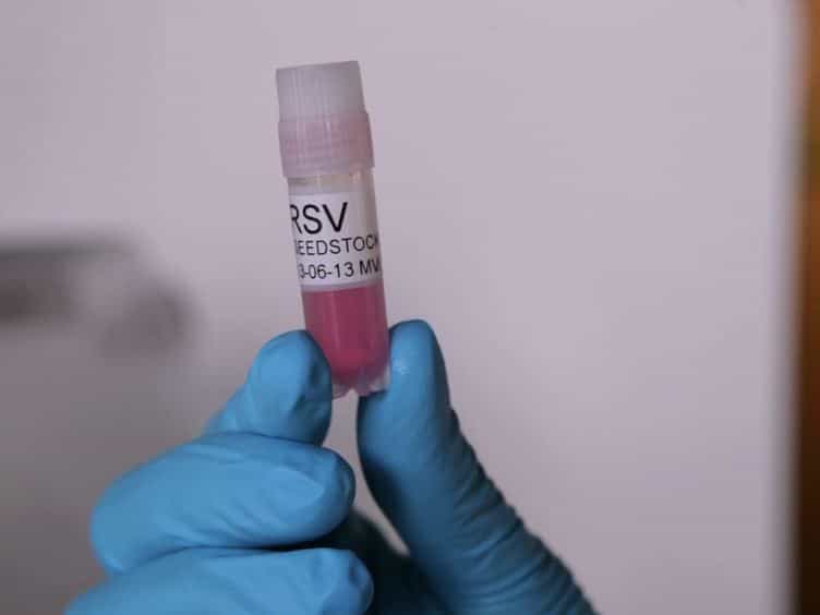 An In vitro Model to Study Immune Responses of Human Peripheral Blood Mononuclear Cells to Human Respiratory Syncytial Virus Infection