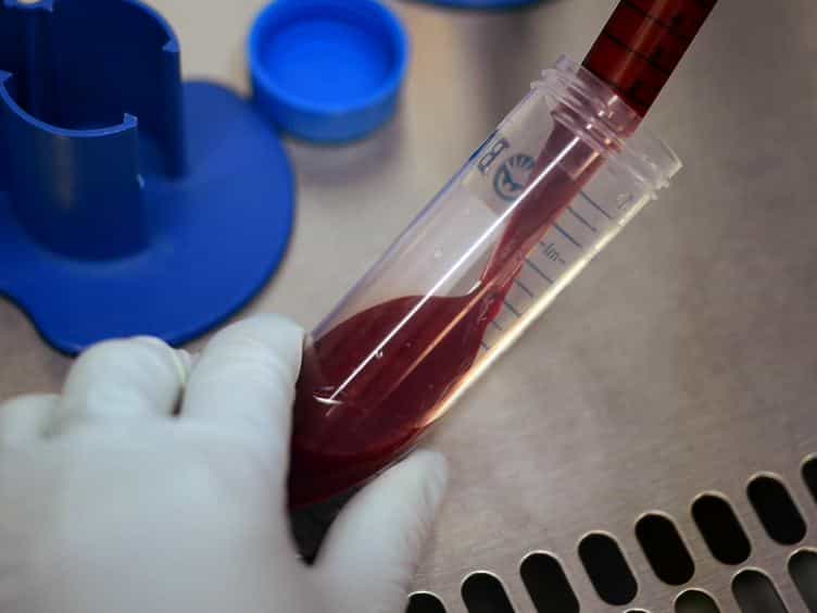 In Vitro Assay to Evaluate the Impact of Immunoregulatory Pathways on HIV-specific CD4 T Cell Effector Function