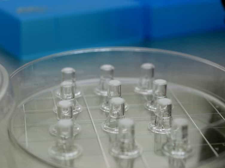 In vitro Coculture Assay to Assess Pathogen Induced Neutrophil Trans-epithelial Migration