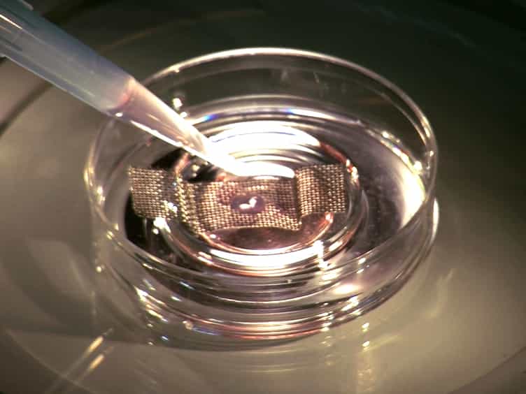 The Slice Culture Method for Following Development of Tooth Germs In Explant Culture