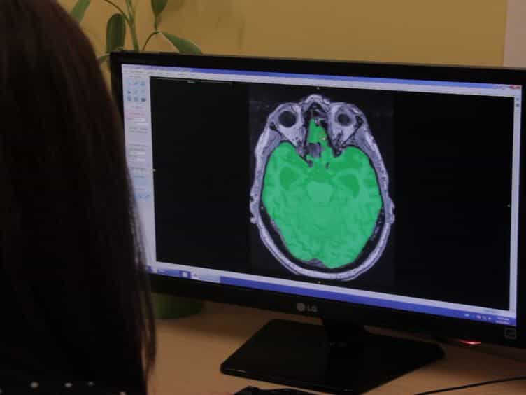 Lesion Explorer: A Video-guided, Standardized Protocol for Accurate and Reliable MRI-derived Volumetrics in Alzheimer's Disease and Normal Elderly