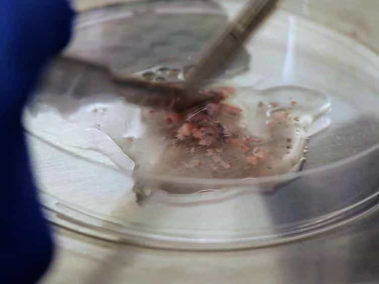 Isolation of Pulmonary Artery Smooth Muscle Cells from Neonatal Mice
