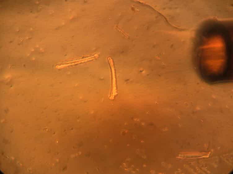 Assessment of Calcium Sparks in Intact Skeletal Muscle Fibers