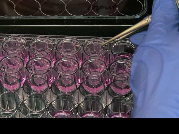 Quantitative Assessment of Human Neutrophil Migration Across a Cultured Bladder Epithelium