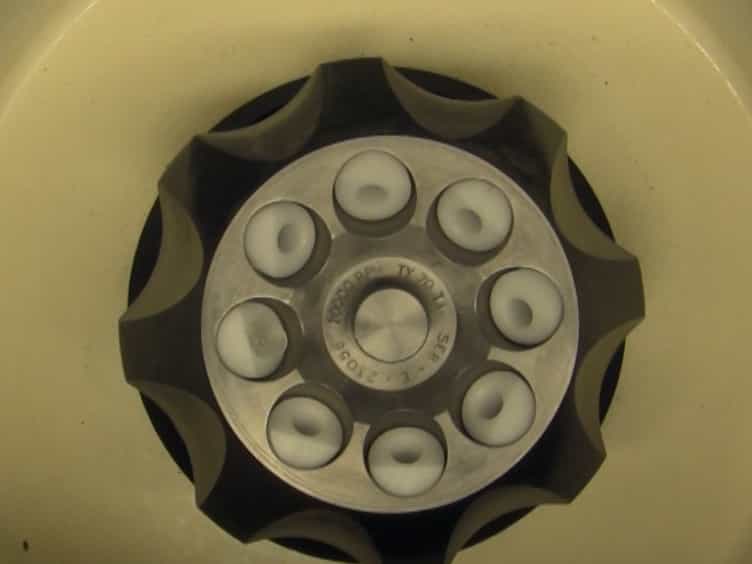 An Innovative Method for Exosome Quantification and Size Measurement