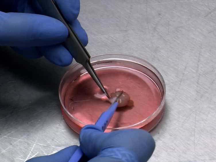 Nucleofection of Rodent Neuroblasts to Study Neuroblast Migration In vitro