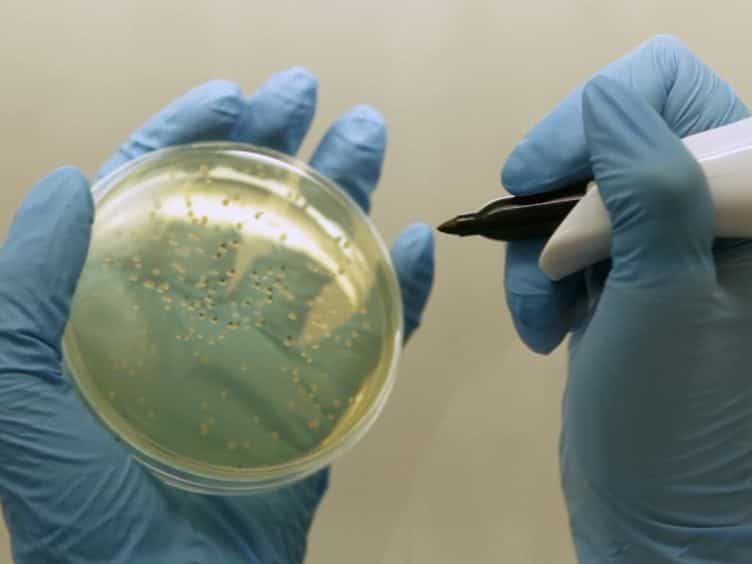 Long Term Chronic Pseudomonas aeruginosa Airway Infection in Mice