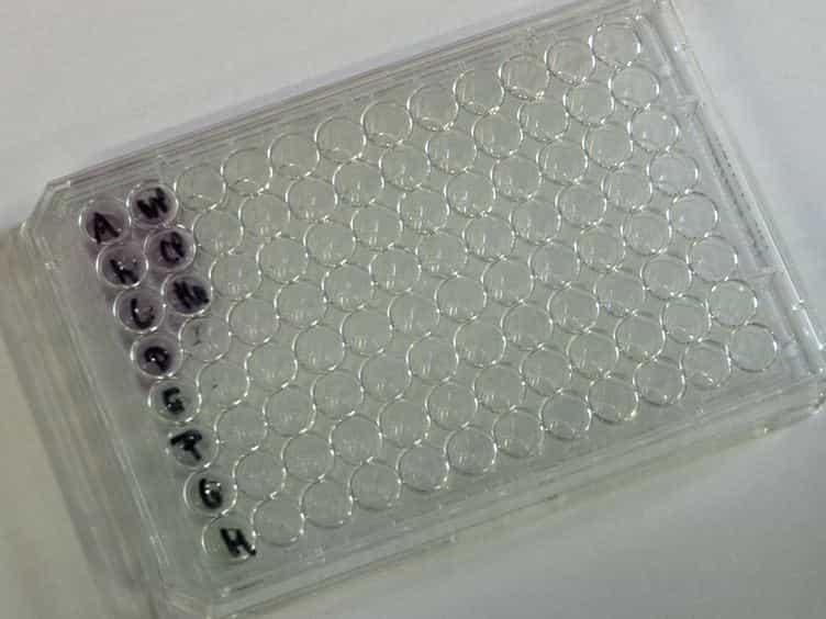Simulating Pancreatic Neuroplasticity: In Vitro Dual-neuron Plasticity Assay