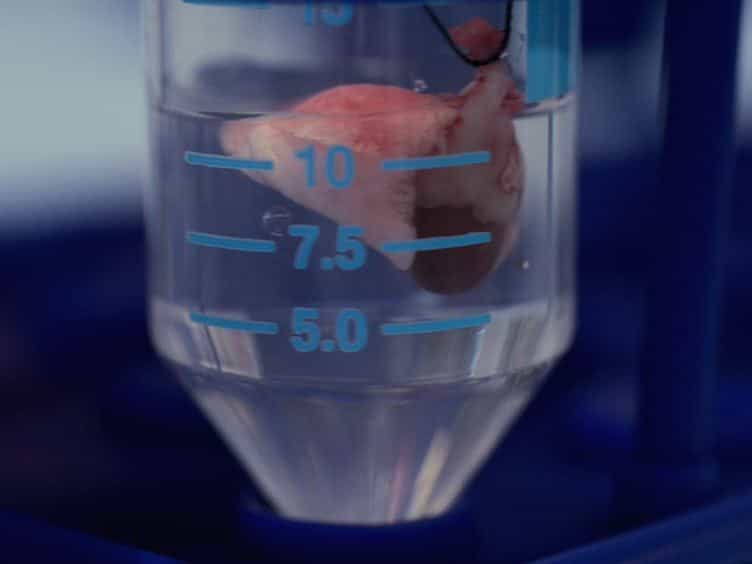 Cecal Ligation and Puncture-induced Sepsis as a Model To Study Autophagy in Mice
