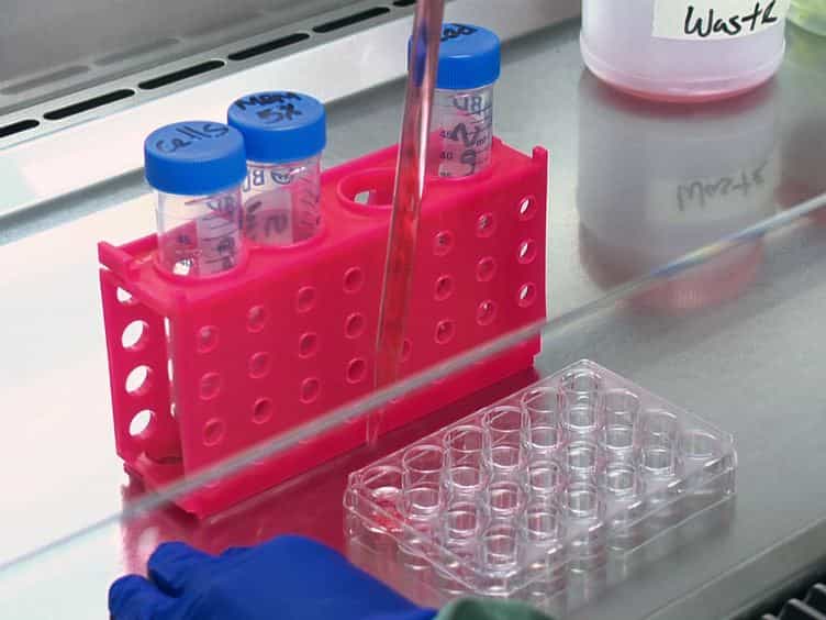 Investigating the Effects of Probiotics on Pneumococcal Colonization Using an In Vitro Adherence Assay