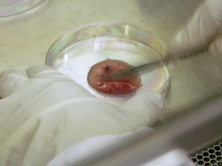 Optimization of High Grade Glioma Cell Culture from Surgical Specimens for Use in Clinically Relevant Animal Models and 3D Immunochemistry