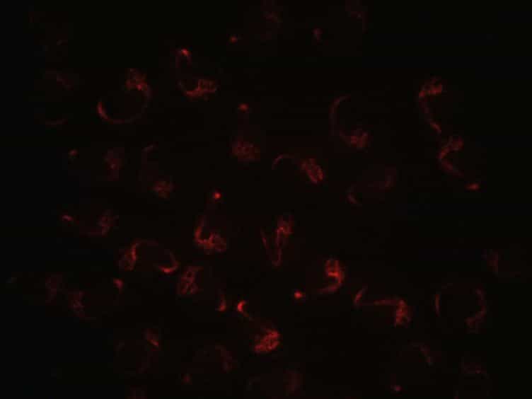 Multilayer Mounting for Long-term Light Sheet Microscopy of Zebrafish