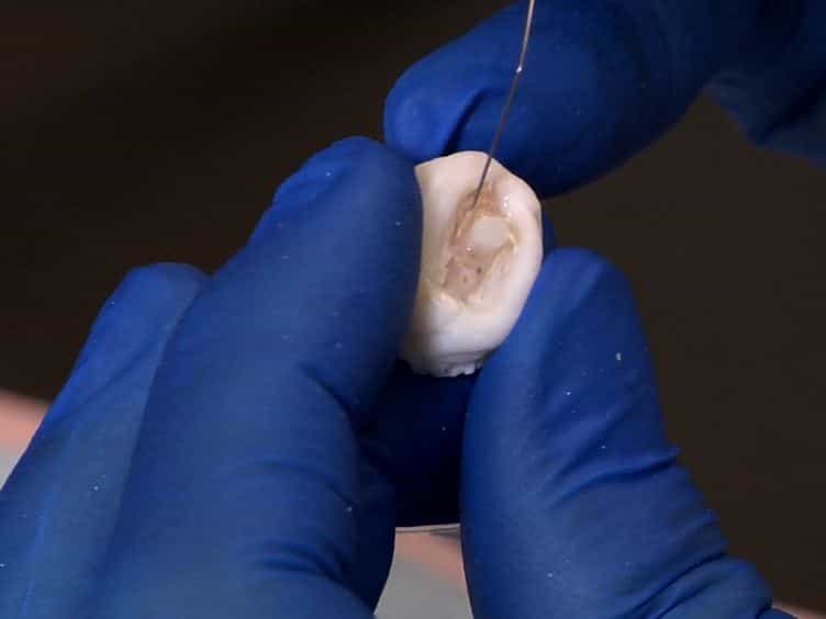 In situ Compressive Loading and Correlative Noninvasive Imaging of the Bone-periodontal Ligament-tooth Fibrous Joint
