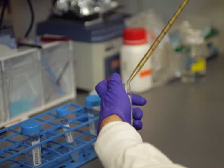 A Modified Precipitation Method to Isolate Urinary Exosomes