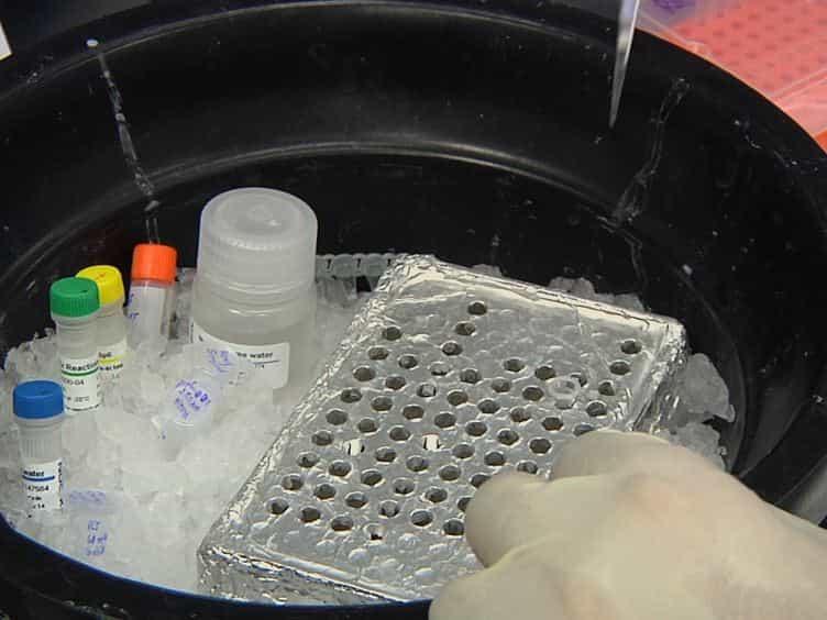 Cerebrospinal Fluid MicroRNA Profiling Using Quantitative Real Time PCR