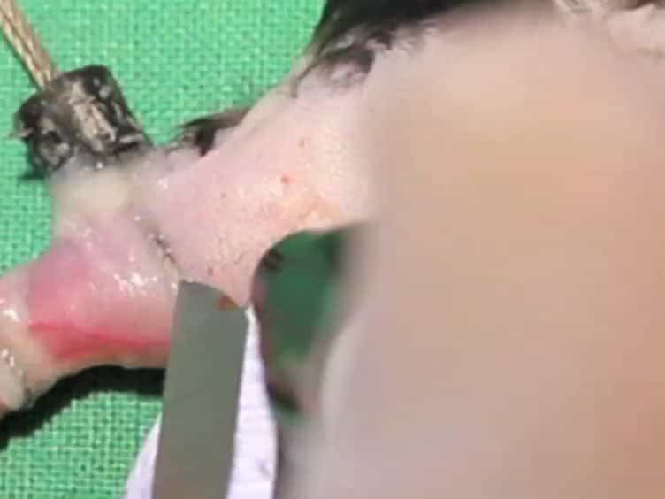 In Vivo Electrophysiological Measurements on Mouse Sciatic Nerves