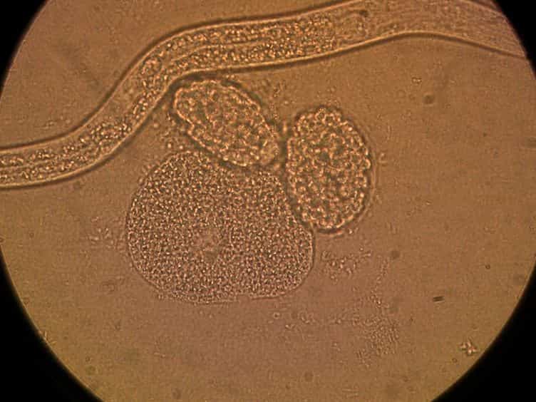 Visualizing Neuroblast Cytokinesis During C. elegans Embryogenesis