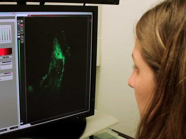 Visualization of G3BP Stress Granules Dynamics in Live Primary Cells