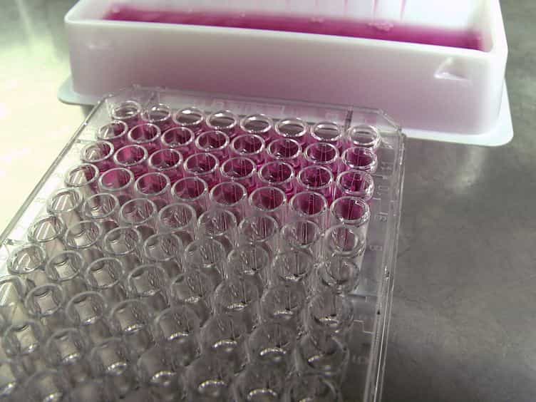 Assessing the Innate Sensing of HIV-1 Infected CD4+ T Cells by Plasmacytoid Dendritic Cells Using an Ex vivo Co-culture System.