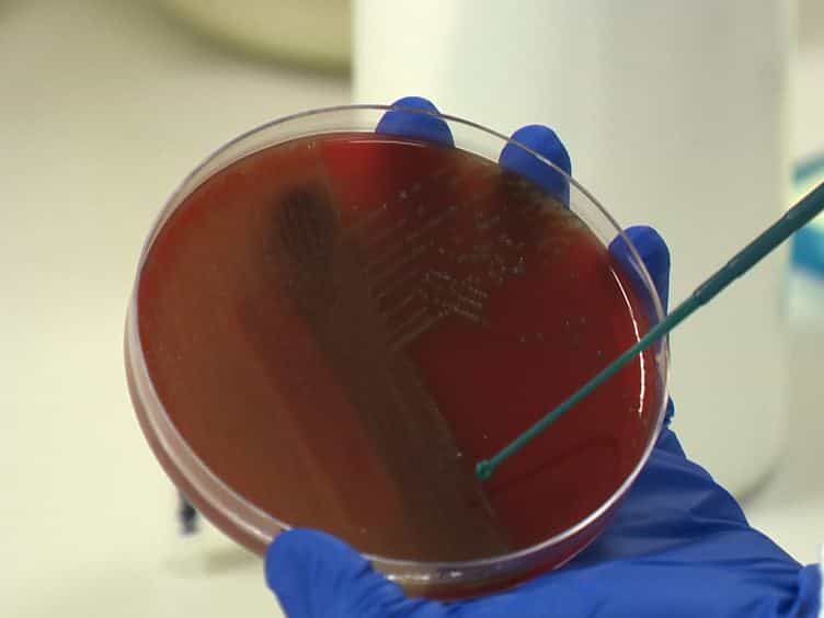 Capsular Serotyping of Streptococcus pneumoniae Using the Quellung Reaction