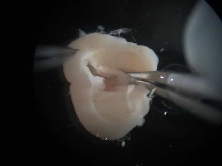 One Mouse, Two Cultures: Isolation and Culture of Adult Neural Stem Cells from the Two Neurogenic Zones of Individual Mice