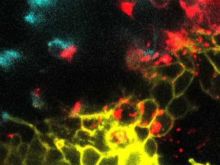Imaging Through the Pupal Case of Drosophila melanogaster